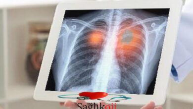 Photo of Amerikan Kanseri Derneği açıkladı akciğer kanserinde tarama yaşı düştü