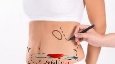 Photo of Liposuction uygulaması nedir?