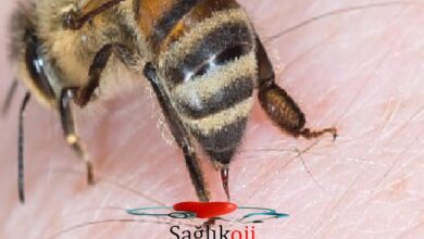 Photo of Arı sokmasında Adrenalin Otoenjektörü hayat kurtarıyor